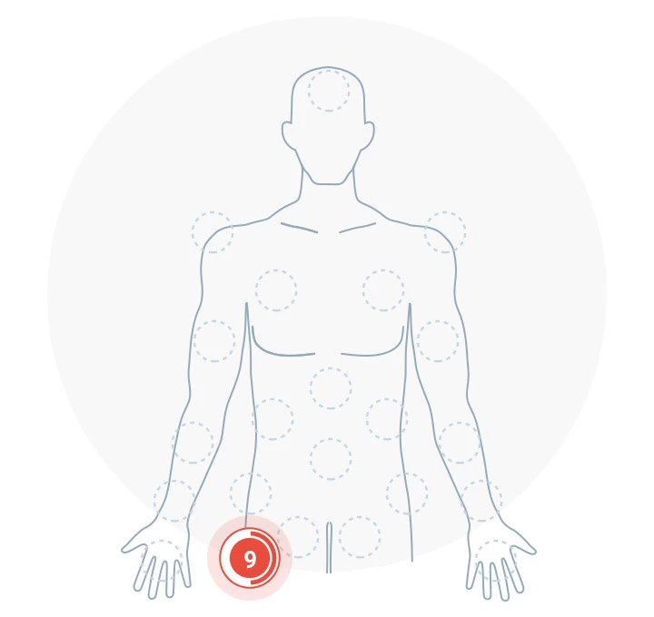 Pain and Injury Report tool